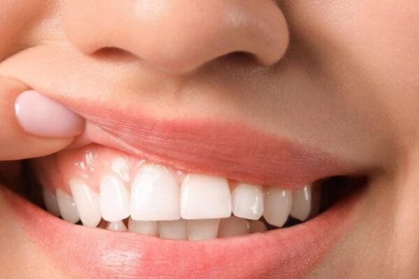 5 effective home remedies for gingivitis and pain relief from pain.