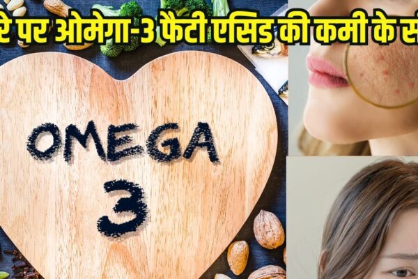 Signs of deficiency of Omega-3 Fatty Acids on Skin: 5 serious signs of omega-3 fatty acid deficiency on the skin