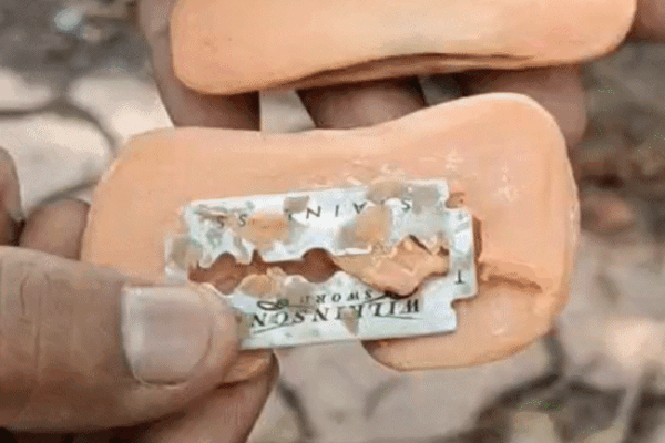 Blade found in Soap in Gwalior | Blade in detol soap, baby cheeks chopped: Blood started flowing while bathing in Gwalior; Father complains in consumer forum – Gwalior News
