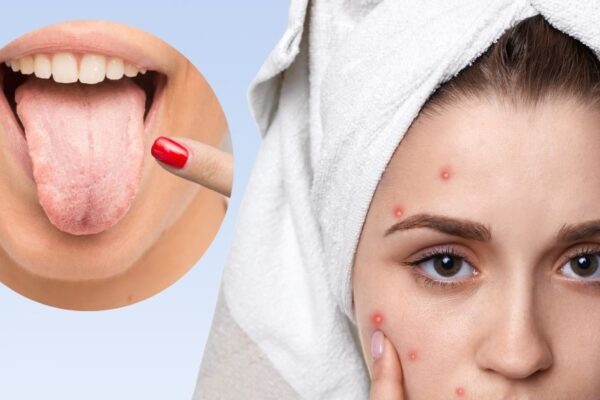 Health Benefits of Saliva: Benefits of Morning Stale saliva