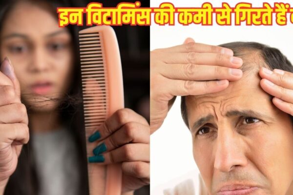 If there is a shortage of these 4 vitamins, then you will start getting bald, not a single hair will be left on the head
