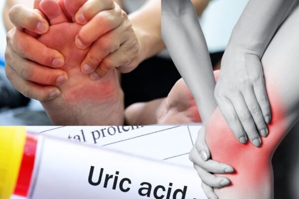7 mg/dl has reached uric acid, 7 work will move directly at 2, will get relief immediately from knee pain