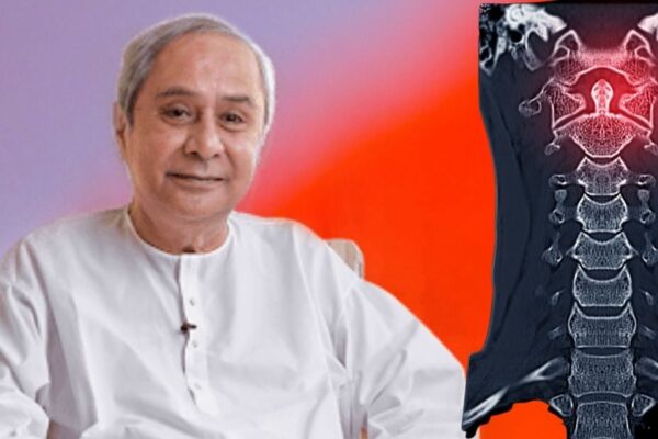Ex-Odisha CM Naveen Patnaik | Undergo Surgical Procedure | Naveen Patnaik to Cervical Arthritis