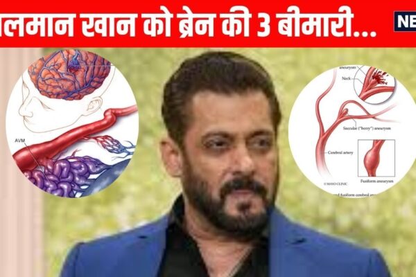 Salman Khan has 3 diseases of the brain, somewhere you are not hunting, know what is aneurysm