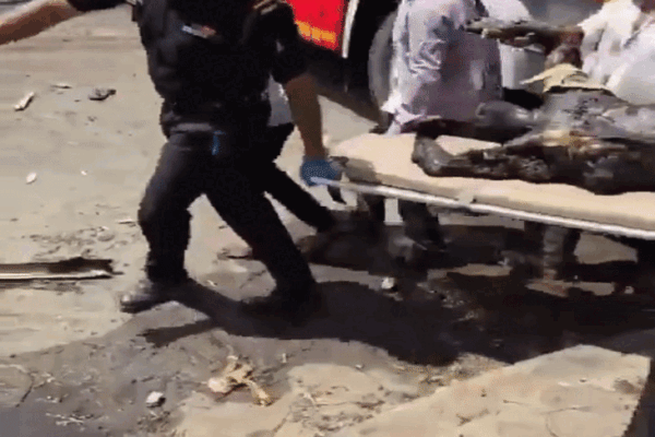 Ahmedabad Plane Crash Victim Identified with Surgical Rod Equipment | Identification of the dead of Ahmedabad Plane Crash from Surgical Rod-Equipment: BJP MLA Dr. Patel said- Deadbody was badly burnt, we tanging