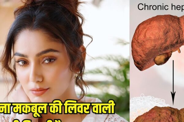TV Actress Sana Makbul Liver Cirrhosis Symptom and Causes: Bigg Boss OTT’s winner Sana Maqbool got liver cirrhosis, learn symptoms causes