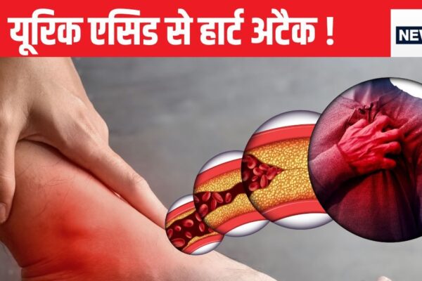 High Uric acid Increase Risk of Heart Attack | How to Control Uric Acid