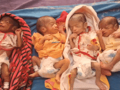 Sirsa Woman Birth Four Children Rajjo Devi Two Boys Girls Husband Sonu Titu Kheda Village Sirsa | In Haryana, the woman gave birth to 4 children together: two boys- two girls, after 3 months of pregnancy, the husband said- this miracle- Sirsa News