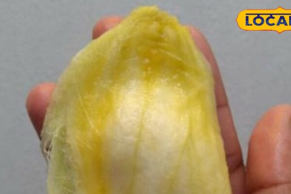 Home Remedies: Garbage is not garbage, mango kernels, boon for heart, benefits will be shocked