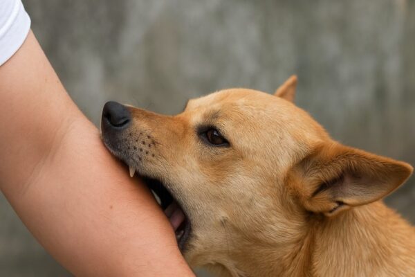 No need to be afraid! How to get anti -rabies injections for free after dog bites, learn full process – uttar pradesh news