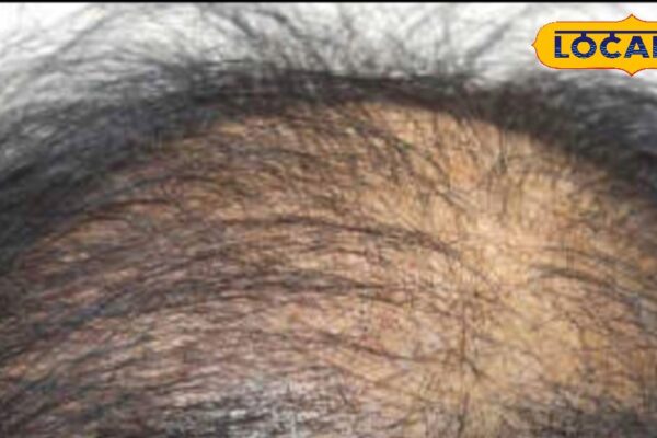 If you are also troubled by hair problem, then adopt these 5 home remedies, the effect will be seen in just 30 minutes!