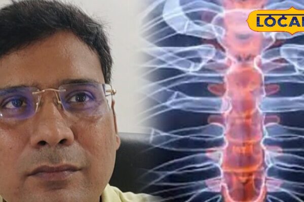 Free bone testing camp on August 13 in Koderma, special facility for this age, will be saved up to 5 thousand