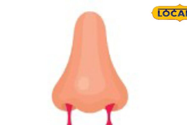 This trick will stop bleeding from the nose immediately, this thing is the biggest doctor in emergency – Uttar Pradesh News