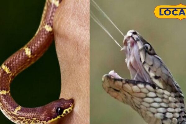 Snake Bite: Do not panic if the snake bites, do this work immediately, you can take a mistake! – Madhya Pradesh News